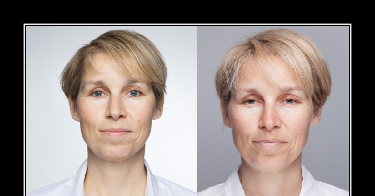 Сахарное лицо до и после отказа фото